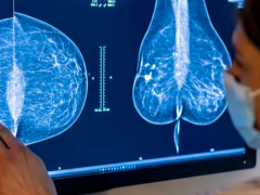 谷歌与医疗技术公司合作开发 AI 乳腺癌筛查工具，目标 2024 年临床部署