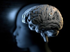 马斯克的脑机接口公司 Neuralink 获得 2.8 亿美元融资，此前已获批进行人体临床试验